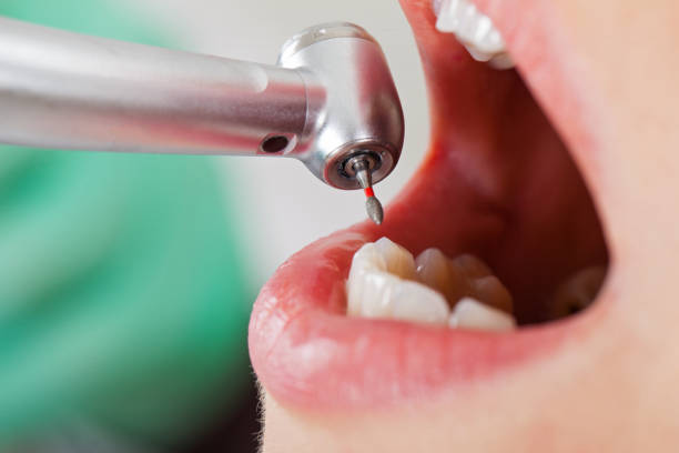 Best Urgent Tooth Repair  in Sheffield Lake, OH